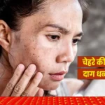 चेहरे के दाग-धब्बे और झाइयां हटाने के घरेलू उपाय