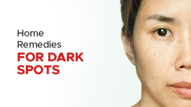 How to Remove Dark Spots from Face in 7 Days